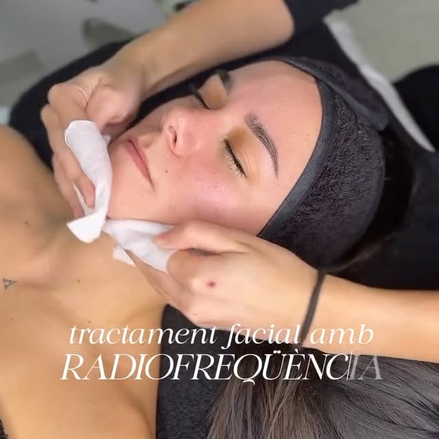 Radiofreqüència