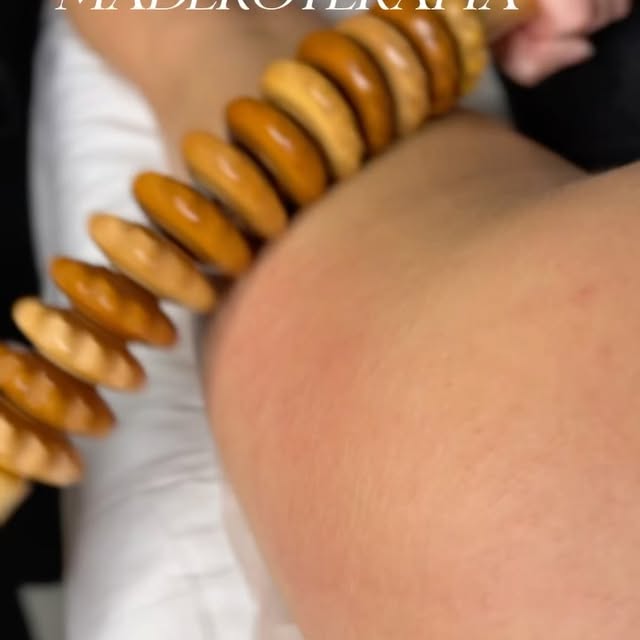 Maderoterapia